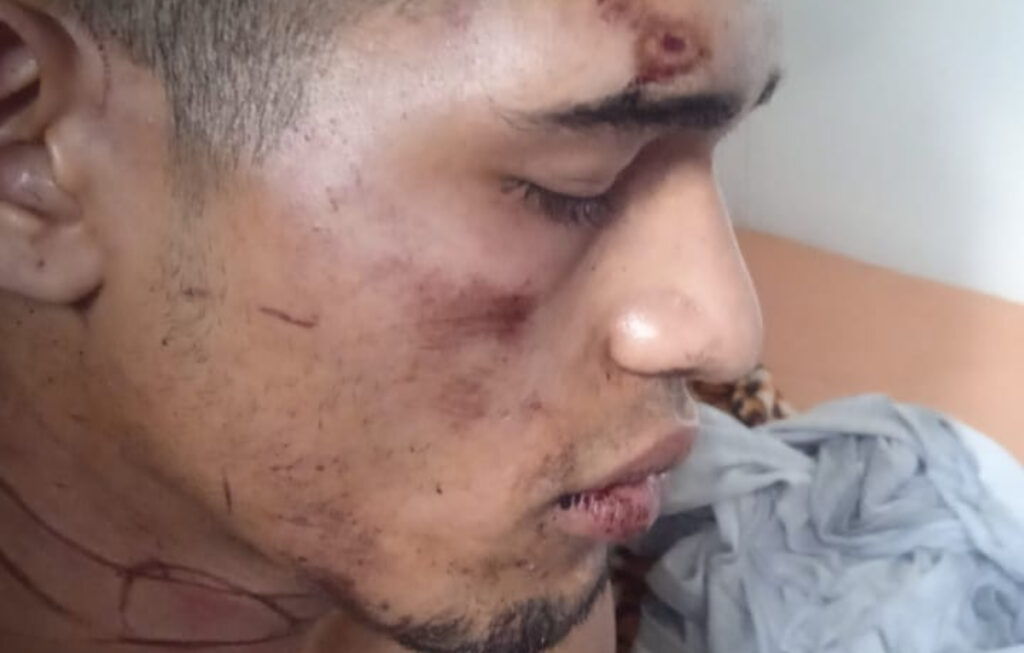 [FOTOS] Guardias del INPEC habrían torturado a un recluso en la cárcel Bellavista: Familiares denuncian brutal agresión 
