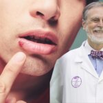 El consejo de un experto farmacéutico para proteger nuestros labios frente al frío