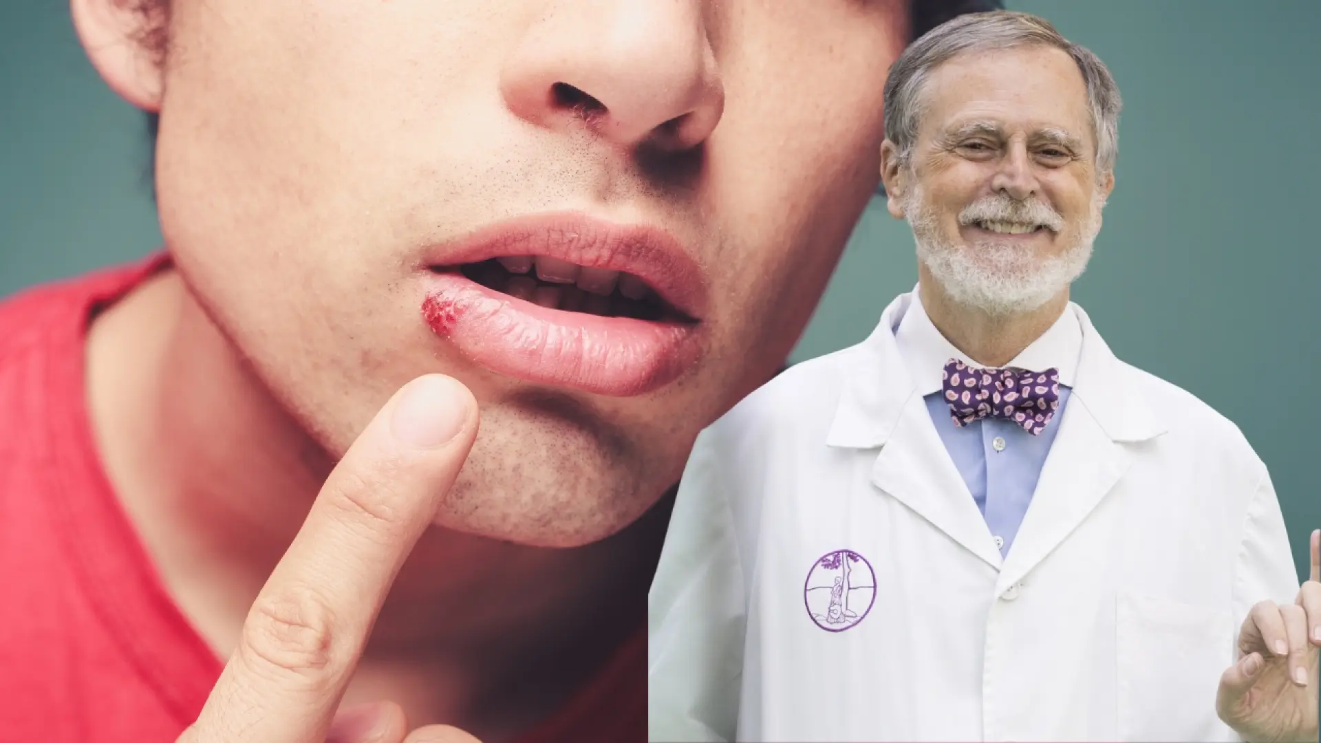 El consejo de un experto farmacéutico para proteger nuestros labios frente al frío