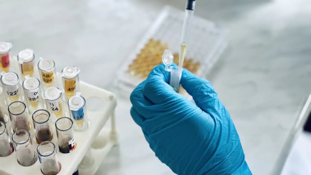 Un nuevo test de sangre para detectar el alzhéimer muestra resultados prometedores en un ensayo clínico Un nuevo test de sangre para detectar el alzhéimer muestra resultados prometedores en un ensayo clínico