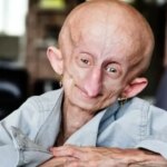 Muere a los 19 años Beandri Booysen, la ‘influencer’ que visibilizó su lucha contra la progeria