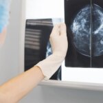 Un fármaco consigue mejorar la supervivencia en pacientes con cáncer de mama agresivo hasta diez años después Un fármaco consigue mejorar la supervivencia en pacientes con cáncer de mama agresivo hasta diez años después