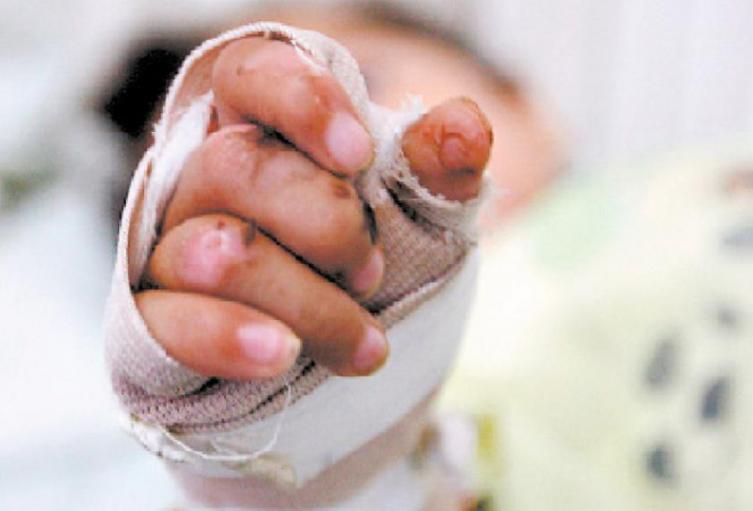 Drama en Guarne: Madre e hijos entre los 5 heridos por pólvora Drama en Guarne: Madre e hijos entre los 5 heridos por pólvora