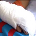 Medellín: Adolescente de 17 años perdió su mano por manipulación de pólvora Medellín: Adolescente de 17 años perdió su mano por manipulación de pólvora