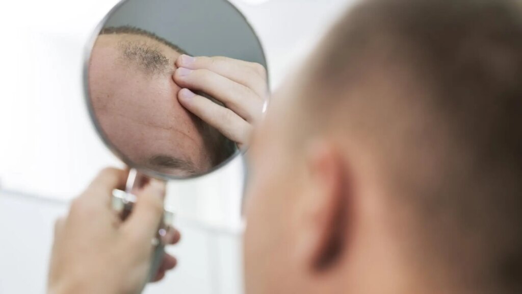 Estos son los cinco alimentos que pueden prevenir la pérdida de cabello, según un nutricionista