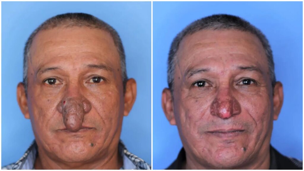 causas, síntomas, tipos y tratamientos disponibles