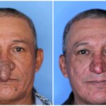 causas, síntomas, tipos y tratamientos disponibles