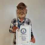 Hipertricosis congénita, el trastorno que padece el joven con la cara más peluda del mundo