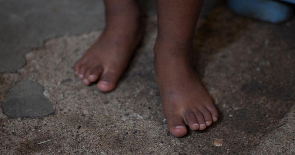 Noticias Antioquia: Reportan cuatro niños indígenas con desnutrición
