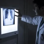 ¿Qué es la amiloidosis? Así se manifiestan los síntomas de la enfermedad que engaña y confunde a los médicos