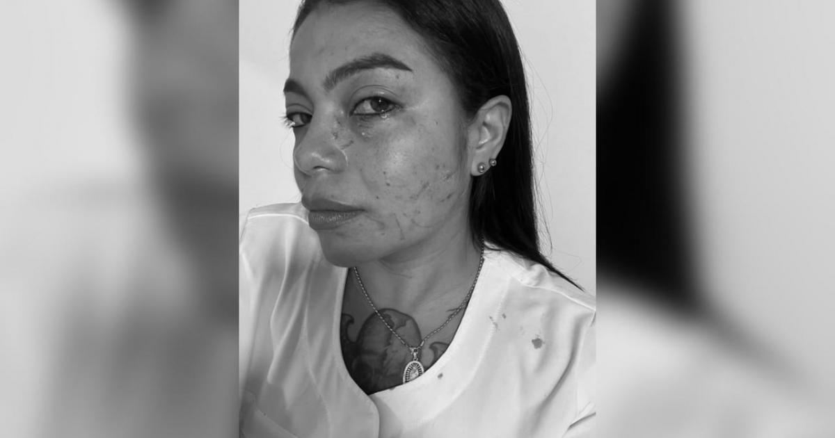 Noticias Antioquia: Mujer golpeó y arañó a una enfermera en Antioquia Noticias Antioquia: Mujer golpeó y arañó a una enfermera en Antioquia