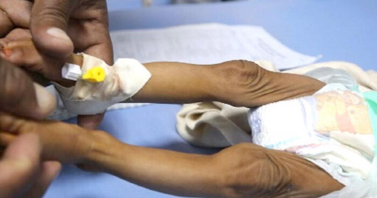 Noticias Antioquia: Alarma por muerte de dos menores por desnutrición Noticias Antioquia: Alarma por muerte de dos menores por desnutrición