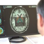 La cera de los oídos, una posible forma sencilla para la detección del párkinson