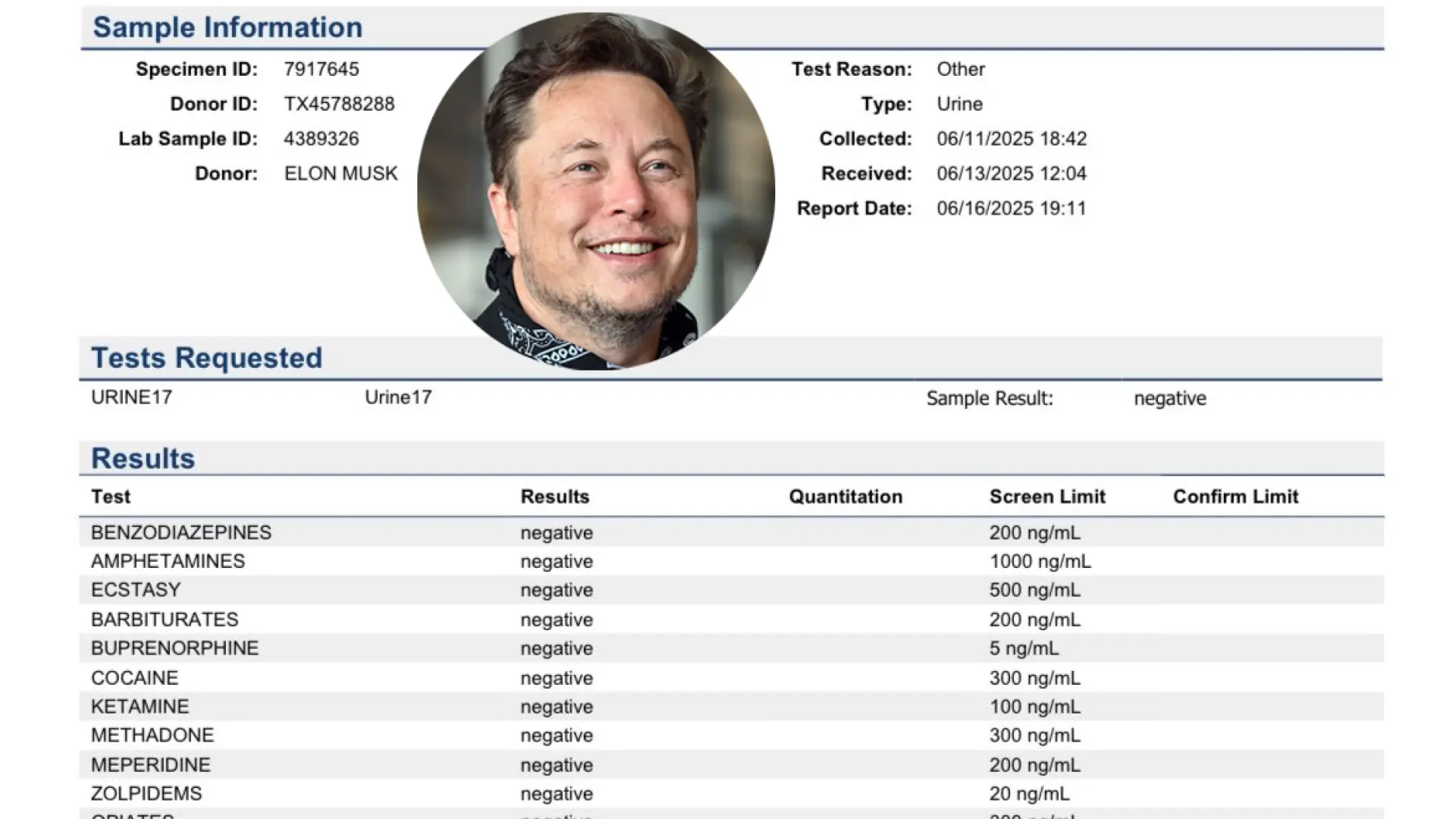 Los esclarecedores resultados del análisis de droga de Elon Musk