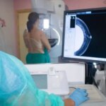 Éxito en el ensayo de un medicamento que mejora la supervivencia de pacientes con cáncer de mama avanzado Éxito en el ensayo de un medicamento que mejora la supervivencia de pacientes con cáncer de mama avanzado