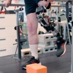 así es la nueva rodilla biónica anclada al hueso y controlada por el sistema nervioso