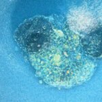 Investigadores españoles graban por primera vez la implantación de un embrión humano en tiempo real: puede mejorar la fertilidad