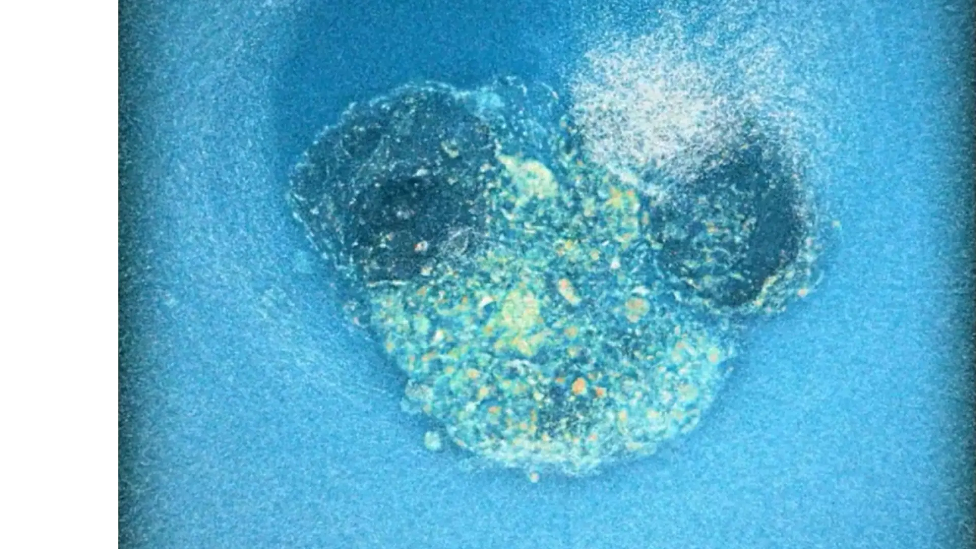 Investigadores españoles graban por primera vez la implantación de un embrión humano en tiempo real: puede mejorar la fertilidad