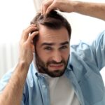 La nueva técnica que promete devolver el cabello sin necesidad de cirugía