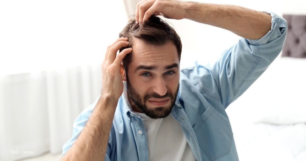 La nueva técnica que promete devolver el cabello sin necesidad de cirugía La nueva técnica que promete devolver el cabello sin necesidad de cirugía