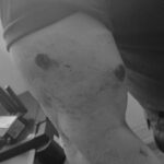 Noticias Antioquia: Comandante operativo de Policía, herido en ataque