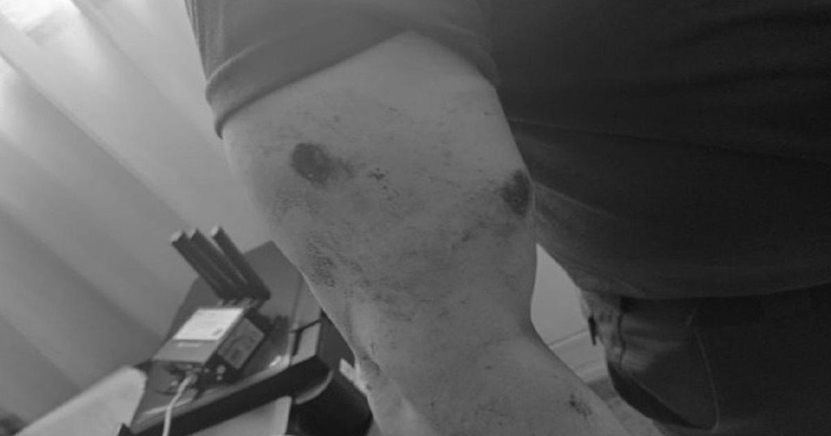 Noticias Antioquia: Comandante operativo de Policía, herido en ataque