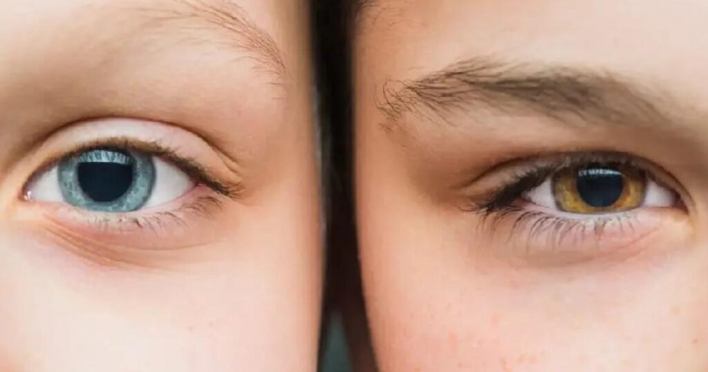 Noticias Medellín: Escaneaba el iris de los ojos por dinero