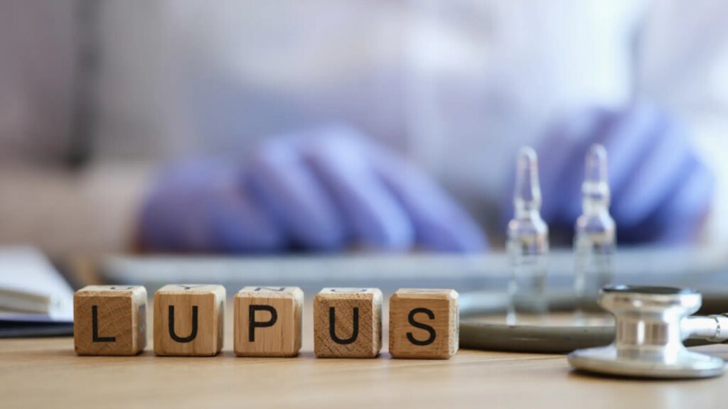 Científicos de Stanford vinculan el lupus con un virus que casi todos los humanos portan Científicos de Stanford vinculan el lupus con un virus que casi todos los humanos portan