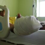 Quemados por pólvora en el Día de Velitas: suben a 23 los lesionados
