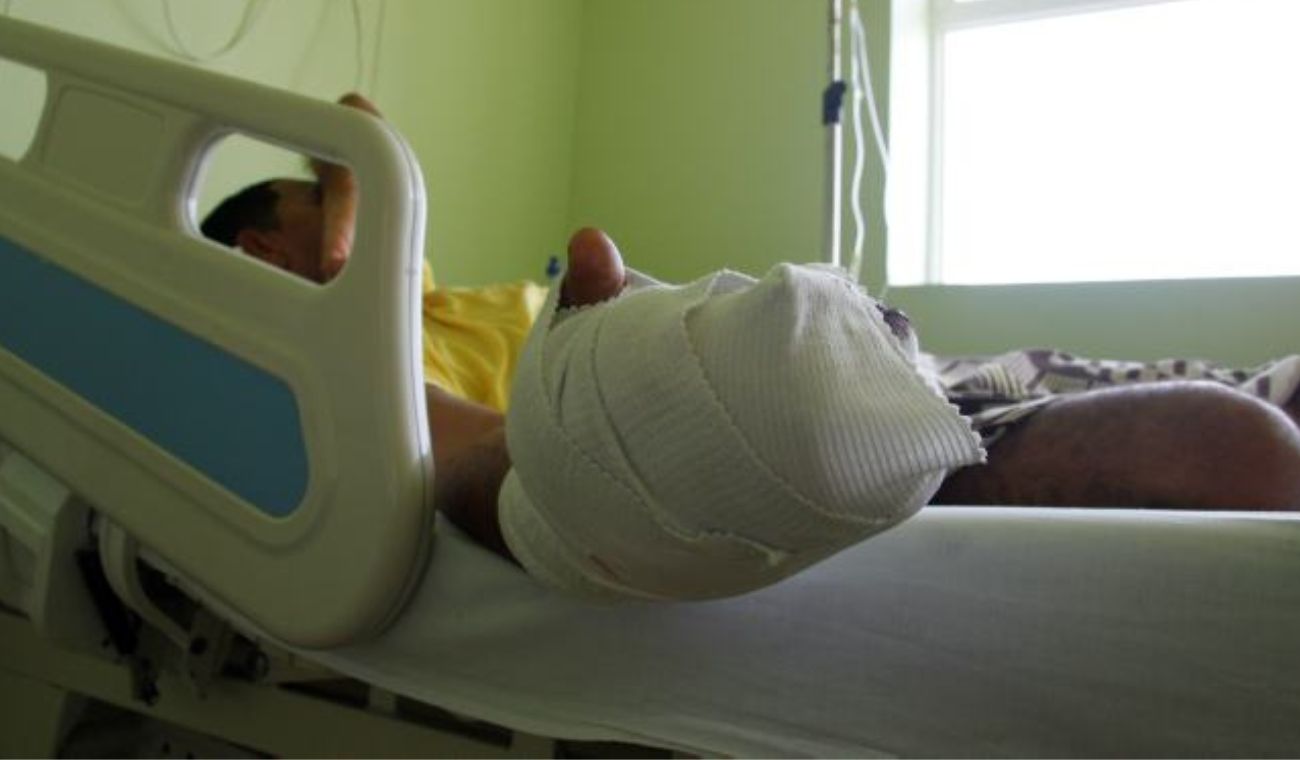 Quemados por pólvora en el Día de Velitas: suben a 23 los lesionados Quemados por pólvora en el Día de Velitas: suben a 23 los lesionados