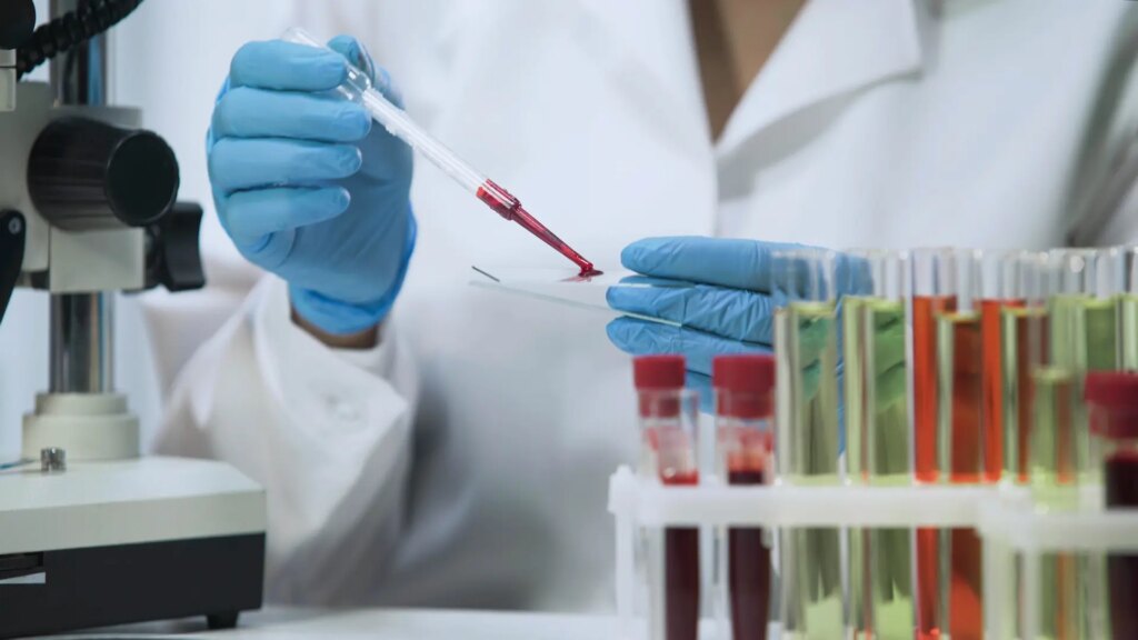 ¿Cómo se transmite el VIH? Estas son todas las fases antes de desarrollarse el SIDA ¿Cómo se transmite el VIH? Estas son todas las fases antes de desarrollarse el SIDA