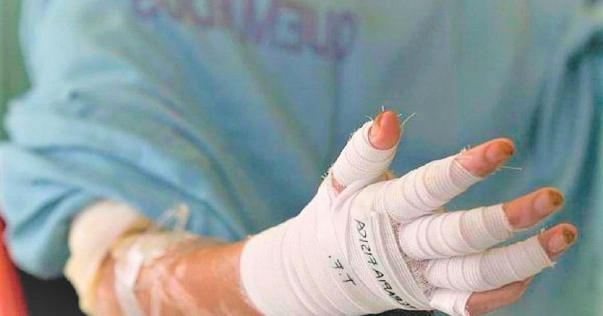 Noticias Antioquia: lesionados pólvora | Alerta Paisa