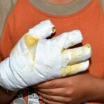 Noticias Antioquia:Por manipular ‘totes’, niño de 10 años sufrió quemaduras Noticias Antioquia:Por manipular ‘totes’, niño de 10 años sufrió quemaduras