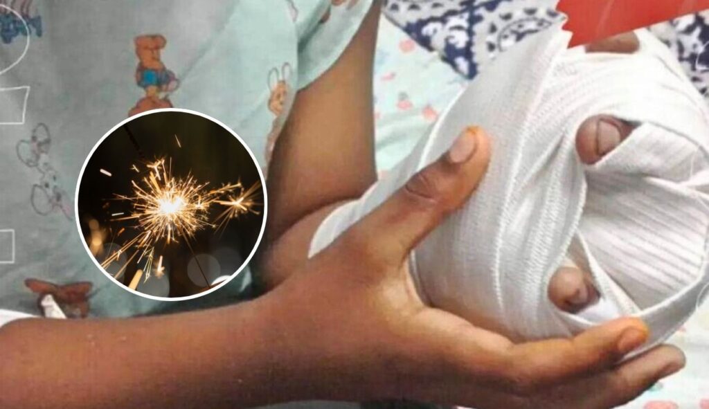 Chispitas Mariposa no son inofensivas: Bomberos alertan por uso de pólvora Chispitas Mariposa no son inofensivas: Bomberos alertan por uso de pólvora