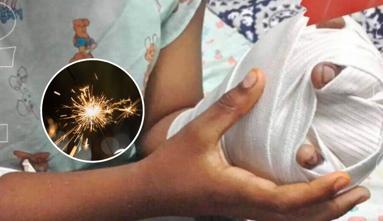 Chispitas Mariposa no son inofensivas: Bomberos alertan por uso de pólvora Chispitas Mariposa no son inofensivas: Bomberos alertan por uso de pólvora