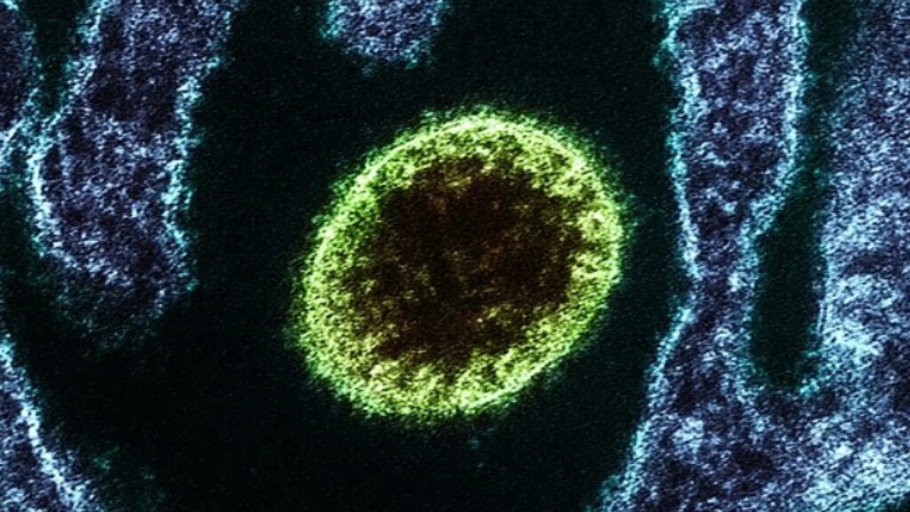 Alerta en la India por un brote del virus Nipah, vigilado por la OMS como posible ‘próxima pandemia’