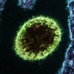 Alerta en la India por un brote del virus Nipah, vigilado por la OMS como posible ‘próxima pandemia’