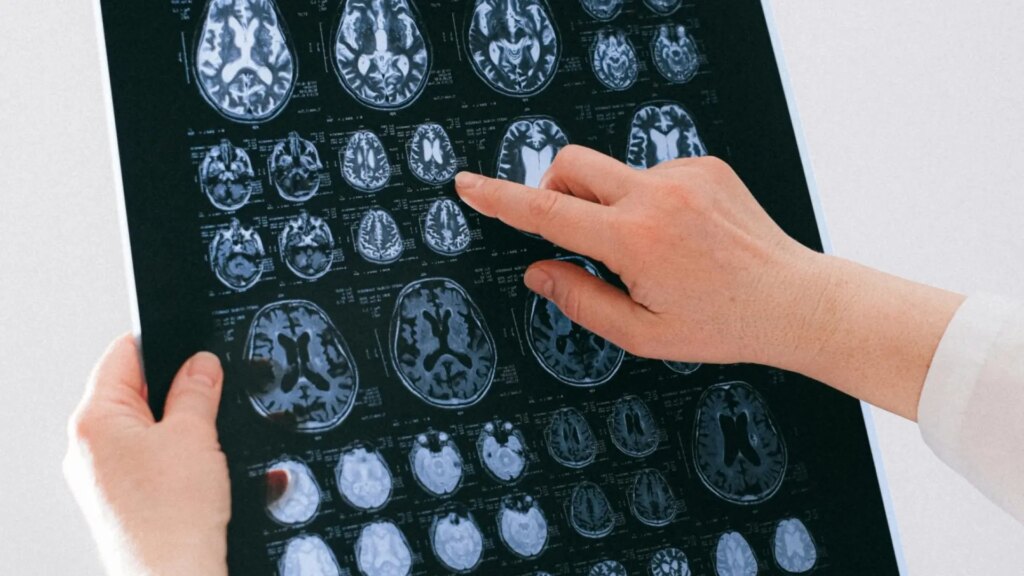La estimulación cerebral puede impulsar a las personas a comportarse de manera menos egoísta