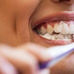 La higiene bucal rigurosa reduce la incidencia de cáncer de mama vinculado a la periodontitis