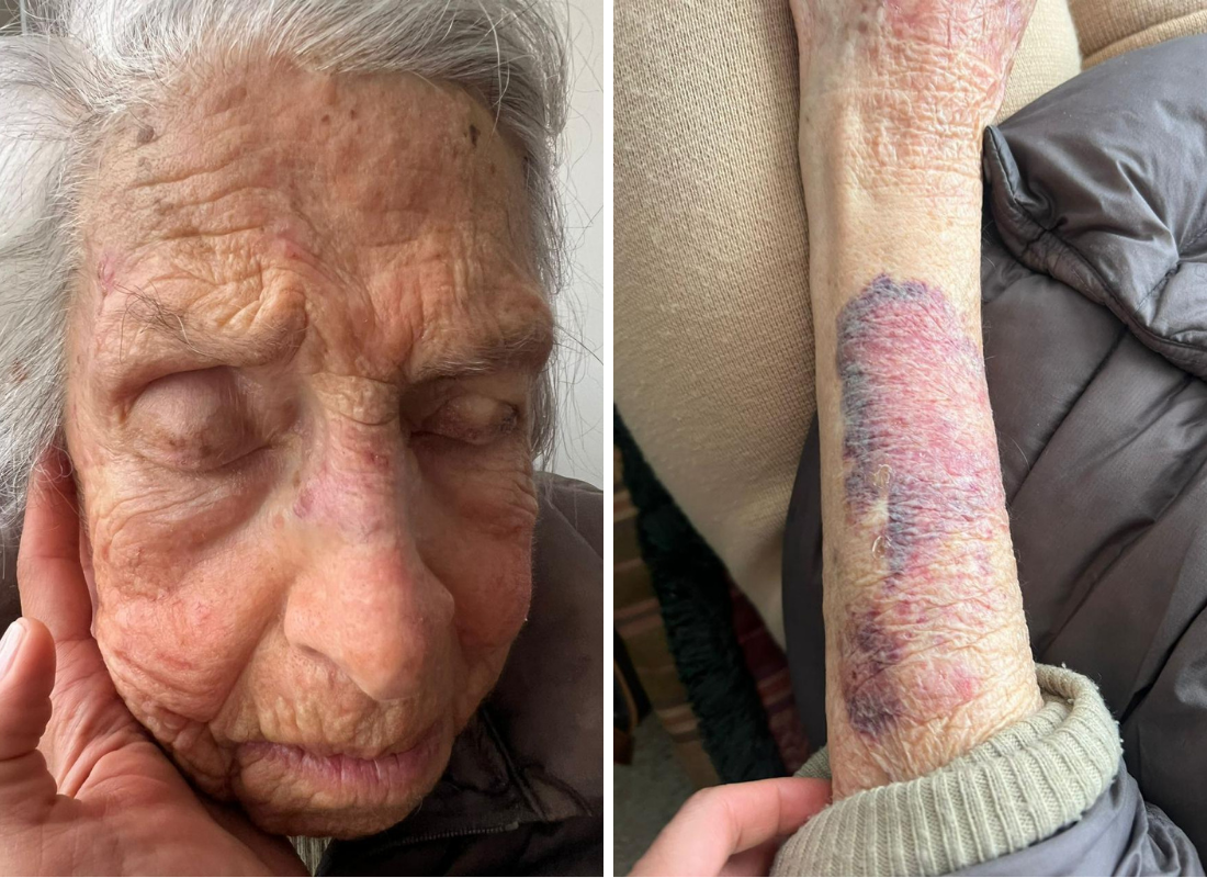 El nuevo caso Jhonier Leal en Bogotá: Ambición, despojo y el calvario de la fundadora de «Elena del Mar».