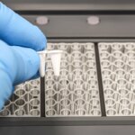 Cómo funciona la RT-PCR con la que se diagnostica el hantavirus