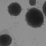Un equipo catalán diseña un método con luz, que activa una molécula y elimina células madre del cáncer, culpables de las recaídas Un equipo catalán diseña un método con luz, que activa una molécula y elimina células madre del cáncer, culpables de las recaídas