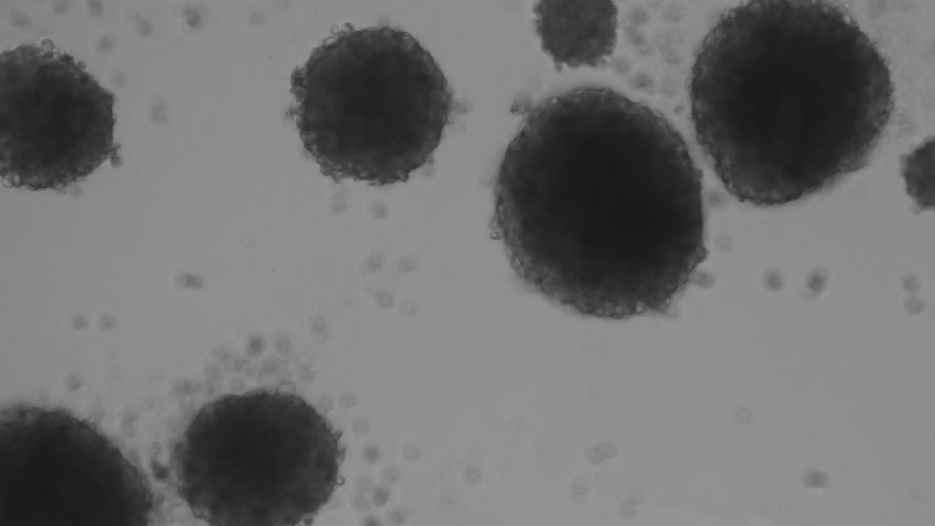 Un equipo catalán diseña un método con luz, que activa una molécula y elimina células madre del cáncer, culpables de las recaídas