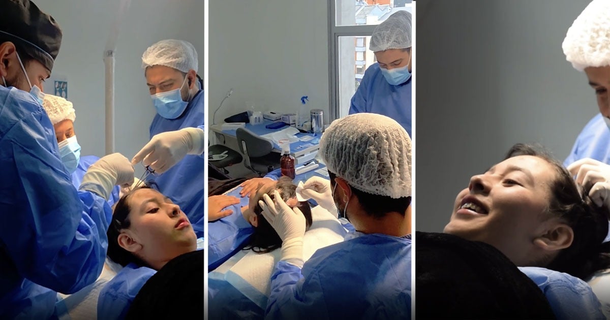 El trasplante capilar que busca devolverle el cabello a una joven que se quemó la cabeza con aceite a los dos años El trasplante capilar que busca devolverle el cabello a una joven que se quemó la cabeza con aceite a los dos años