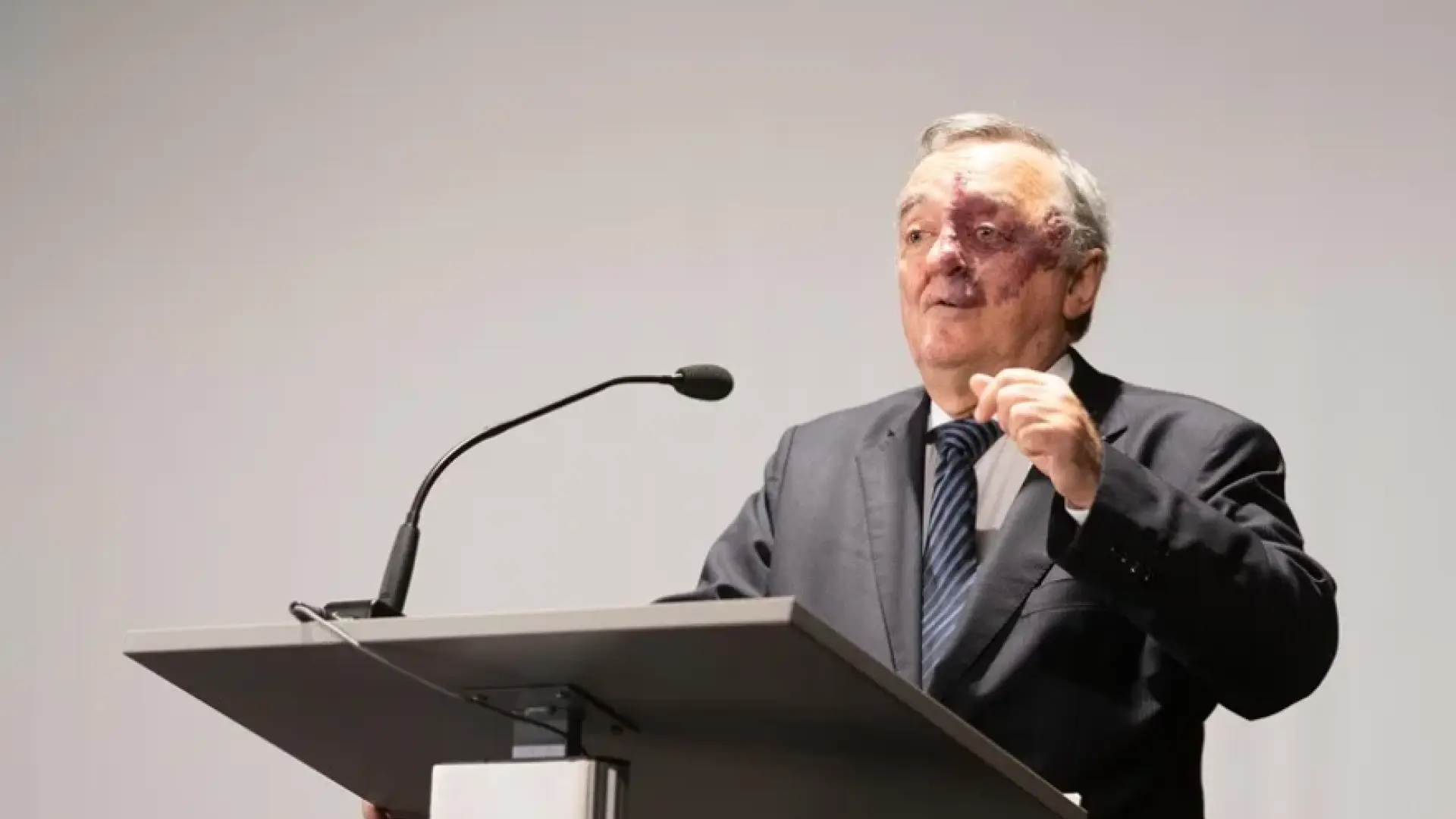«En 2030 el cáncer de páncreas será el segundo cáncer con mayor incidencia» «En 2030 el cáncer de páncreas será el segundo cáncer con mayor incidencia»