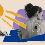 este es el riesgo de melanoma, el cáncer de piel más agresivo este es el riesgo de melanoma, el cáncer de piel más agresivo