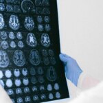 Una terapia génica ya puede cambiar la vida de niños con una rara epilepsia: "Hasta hace poco, no teníamos herramientas" Una terapia génica ya puede cambiar la vida de niños con una rara epilepsia: "Hasta hace poco, no teníamos herramientas"