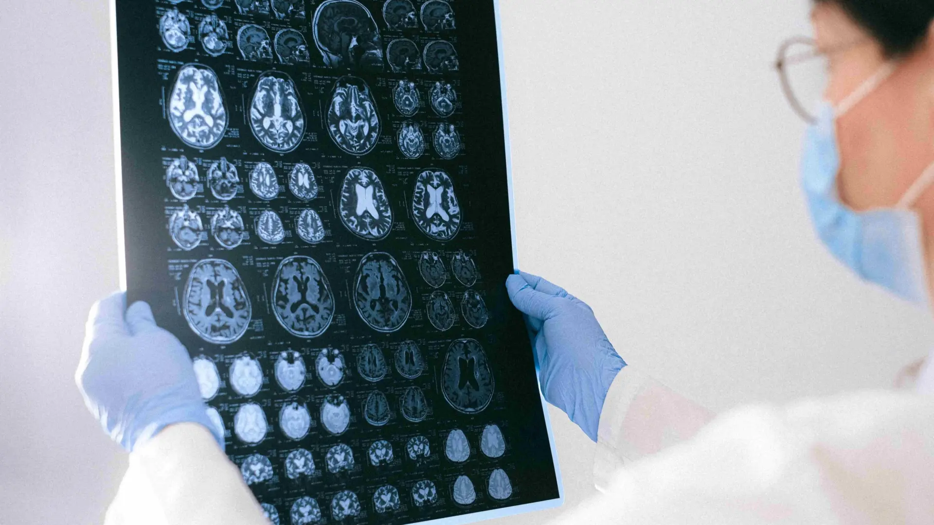 Una terapia génica ya puede cambiar la vida de niños con una rara epilepsia: "Hasta hace poco, no teníamos herramientas" Una terapia génica ya puede cambiar la vida de niños con una rara epilepsia: "Hasta hace poco, no teníamos herramientas"