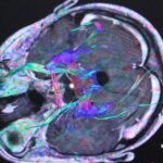 Desarrollan una innovadora prueba para detectar el cáncer cerebral que reduce el diagnóstico de semanas a horas