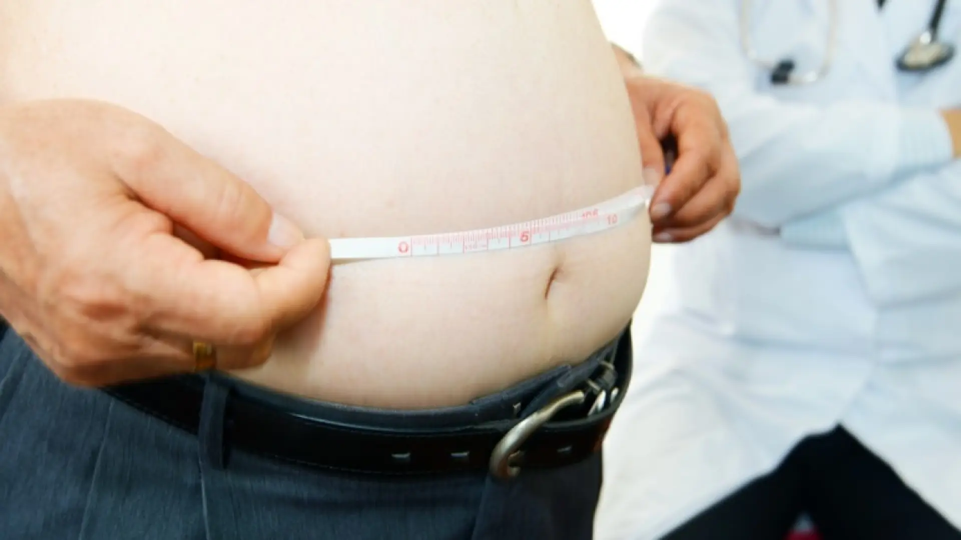 Solo una de cada dos personas con obesidad reconoce que la tiene, pero el 60% considera que es una enfermedad que se debe tratar Solo una de cada dos personas con obesidad reconoce que la tiene, pero el 60% considera que es una enfermedad que se debe tratar